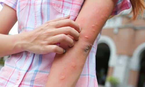 Le zanzare sono responsabili della propagazione di molte importanti malattie quali la malaria, la febbre gialla e l'elenfantiasi